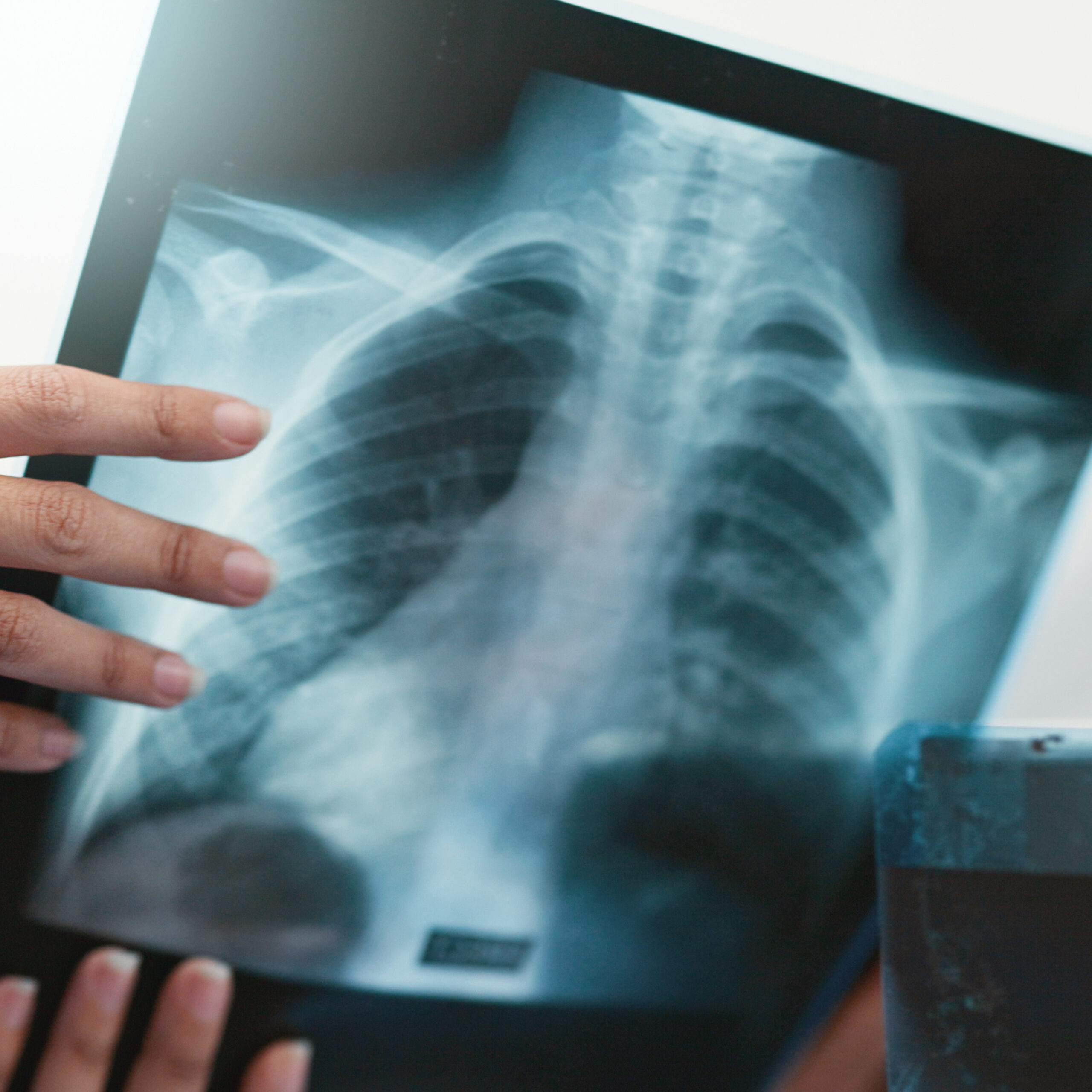 patient-with-headphones-during-a-medical-examinati-2026-01-08-06-59-03-utc 3