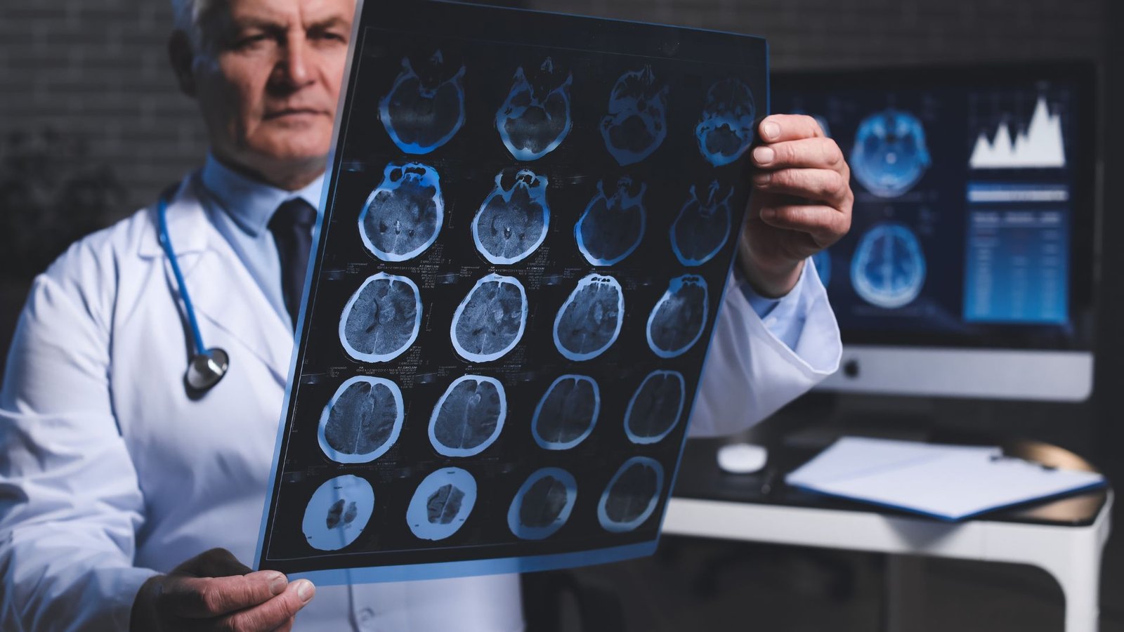 Consulta com neurologista em Santa Luzia MG na Clínica Baronesa, com estrutura completa para diagnóstico.
